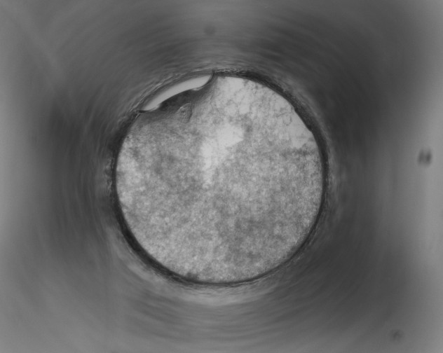 X0000116490017201001061151