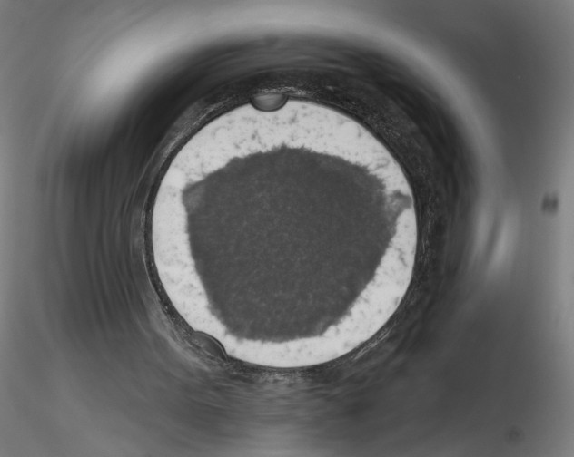 X0000116490099201001061149