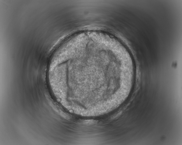 X0000116490153201001061148