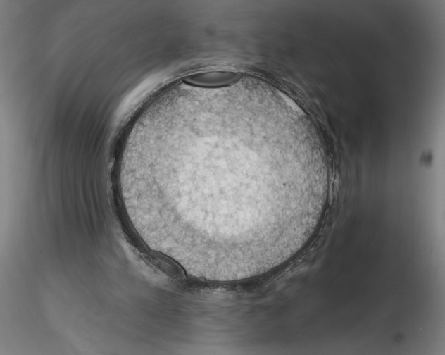 X0000116490197201001061148