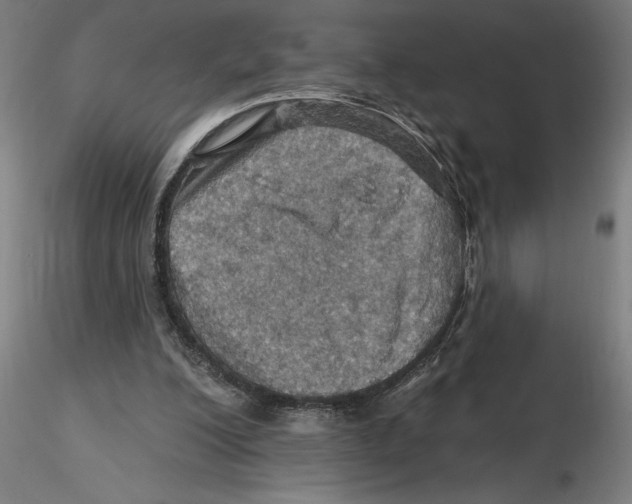 X0000116490200201001061148