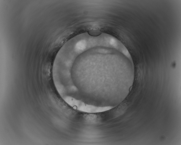 X0000116490230201001061148