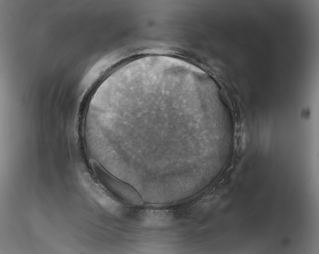 X0000116490296201001061147