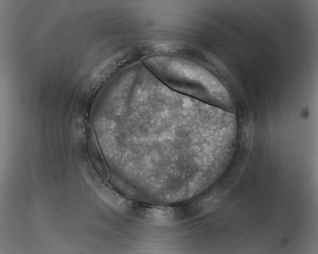 X0000116490317201001061146