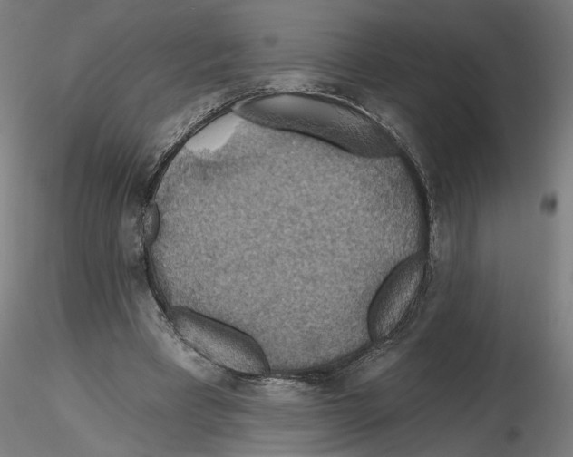 X0000116490393201001061145