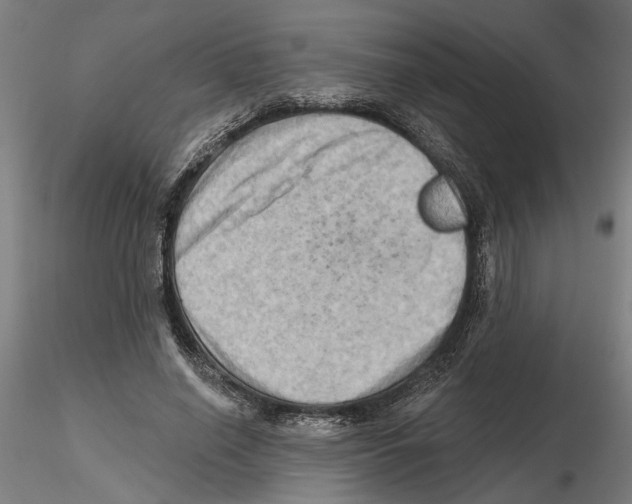 X0000116490638201001061142