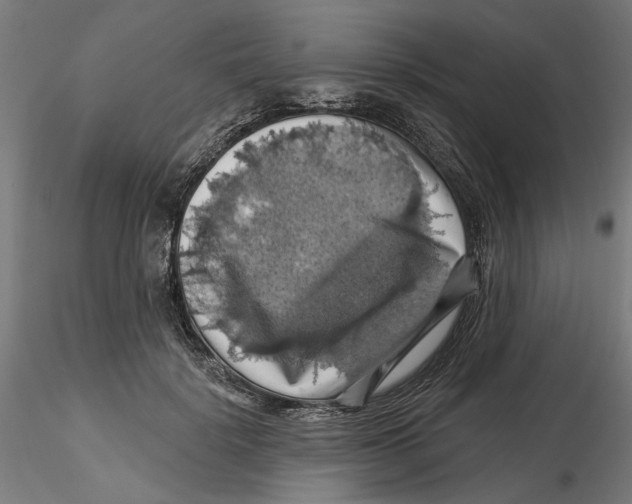 X0000116490652201001061142