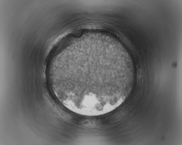 X0000116490727201001061140