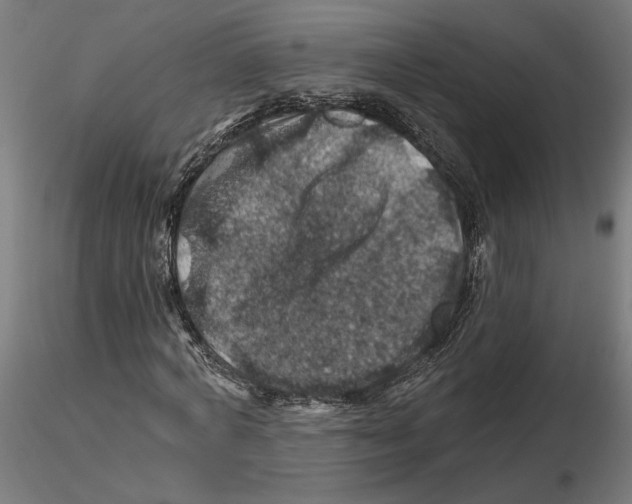 X0000116490772201001061140