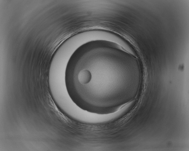 X0000116490793201001061140