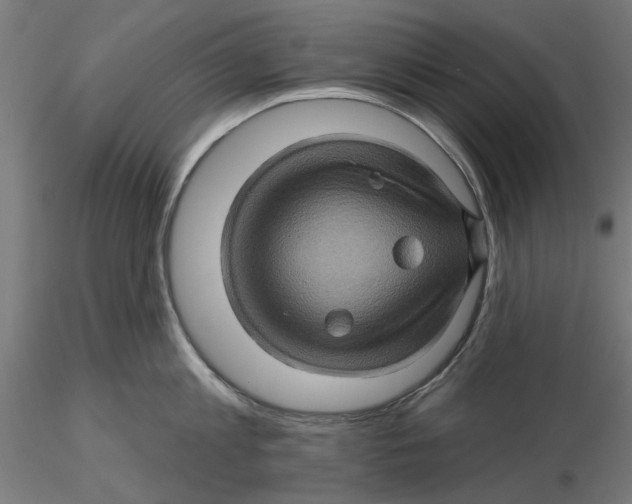 X0000116490813201001061140