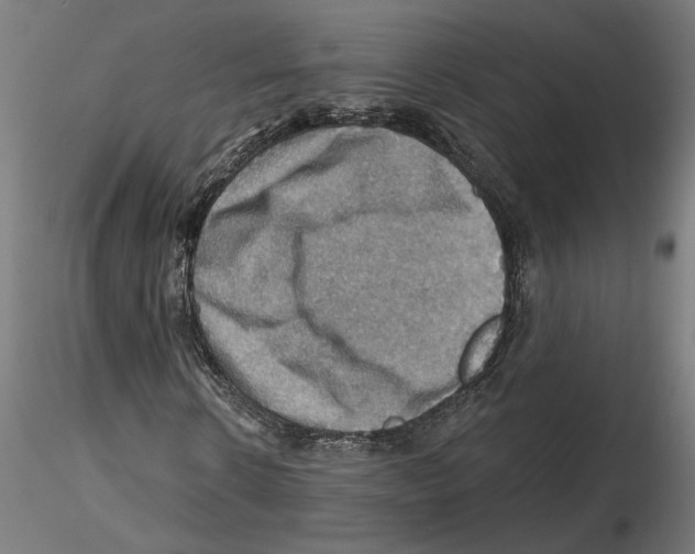 X0000116490914201001061138