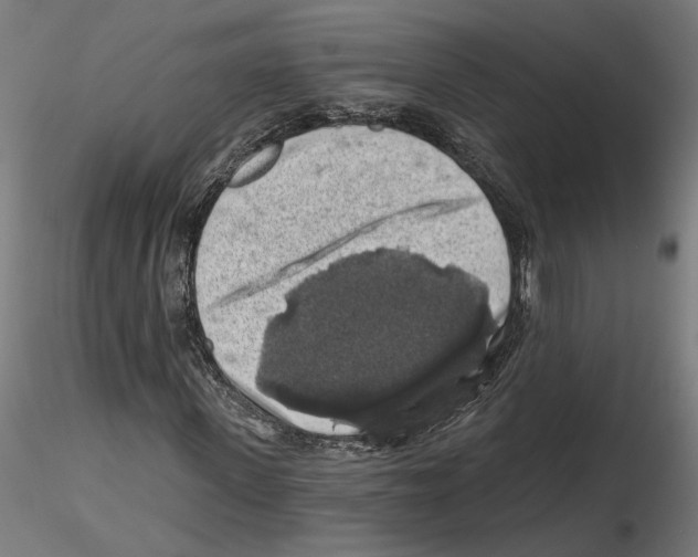 X0000116490915201001061138