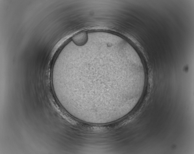 X0000116490933201001061138