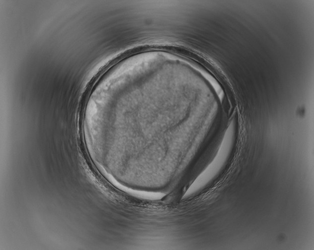 X0000116490935201001061138