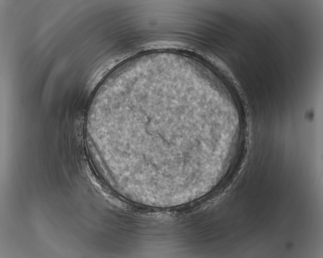 X0000116490937201001061138