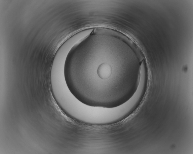 X0000116490993201001061137