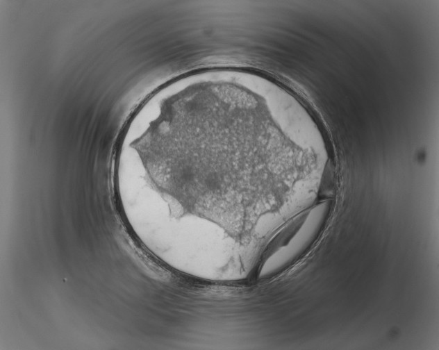 X0000116491179201001061135