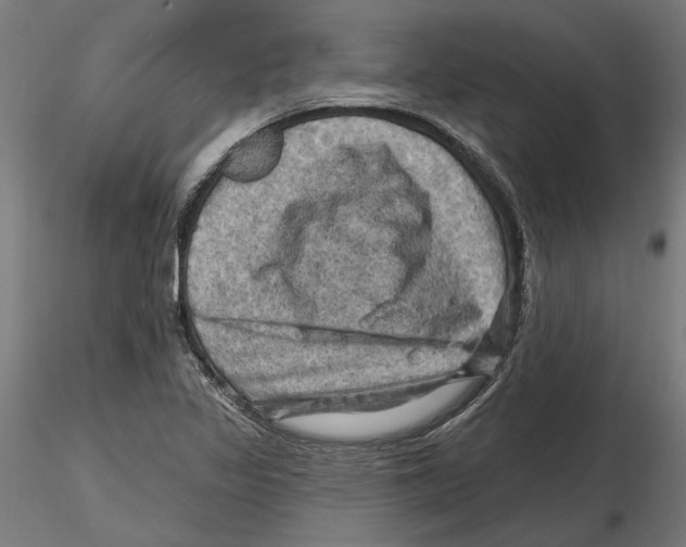 X0000116491317201001061133