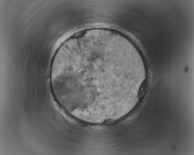 X0000116491373201001061132