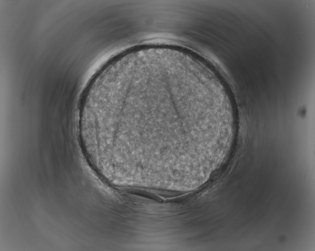 X0000116491376201001061132