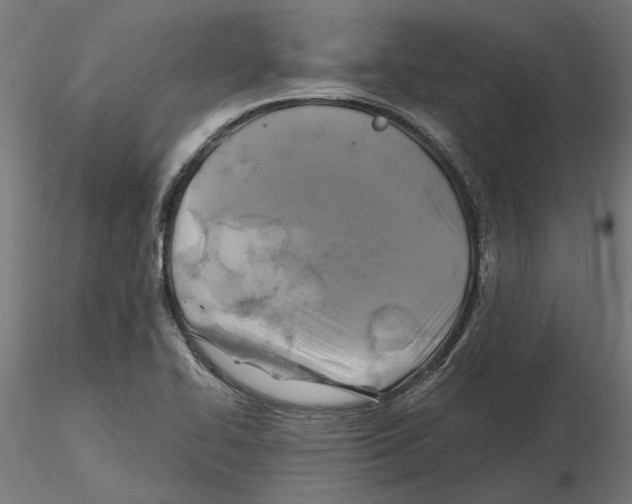 X0000116491414201001061131