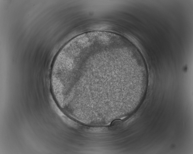 X0000116491434201001061132