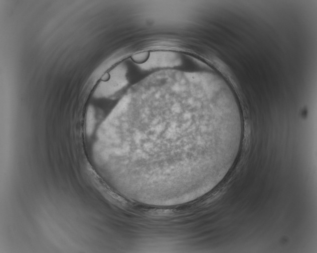 X0000116491435201001061132