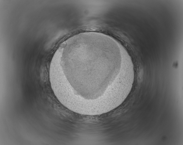 X0000116491446201001061131