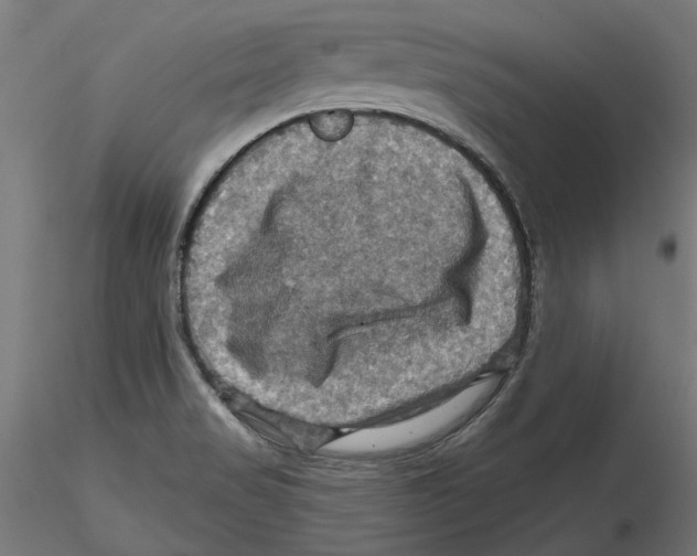 X0000116491517201001061130