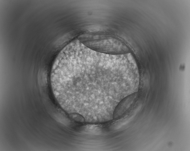 X0000116490117201001201411