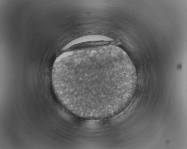 X0000116490136201001201411