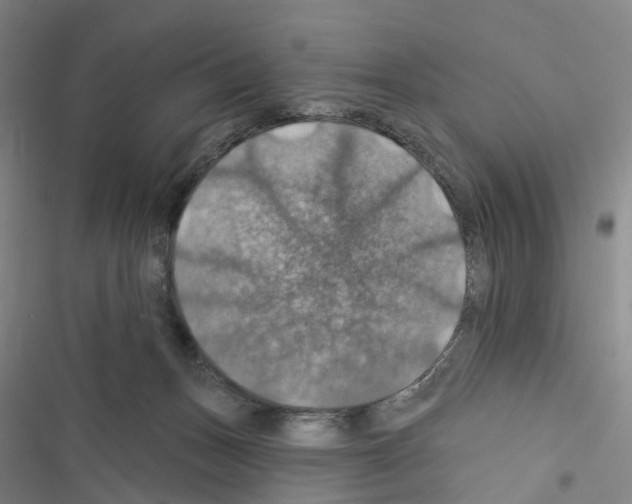 X0000116490175201001201411