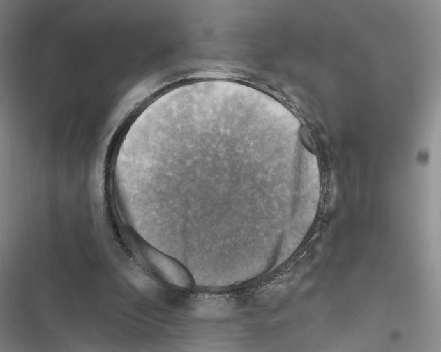 X0000116490296201001201409