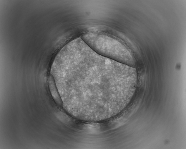 X0000116490317201001201409