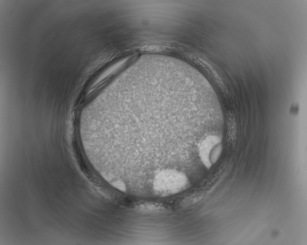 X0000116490586201001201405