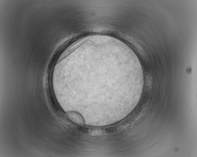 X0000116490587201001201405