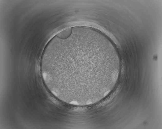 X0000116491513201001201352