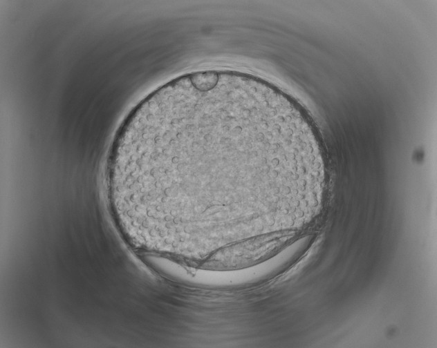 X0000116491517201001201352