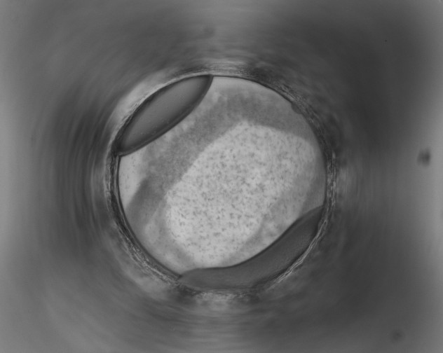 X0000116510294201001061229