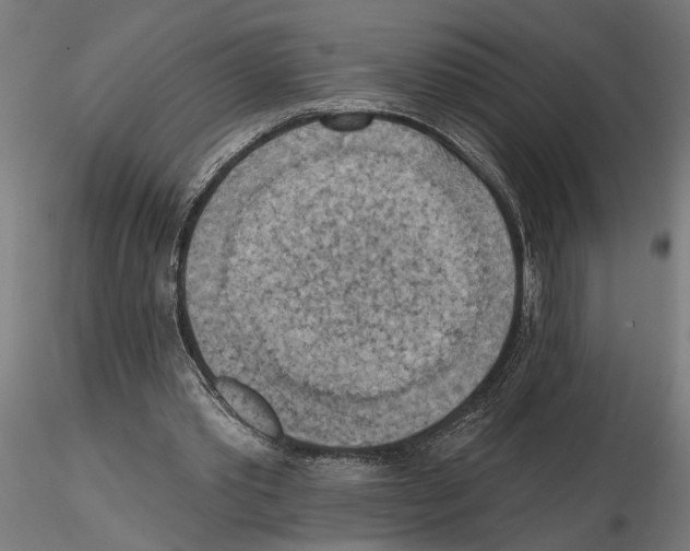 X0000116510389201001061227