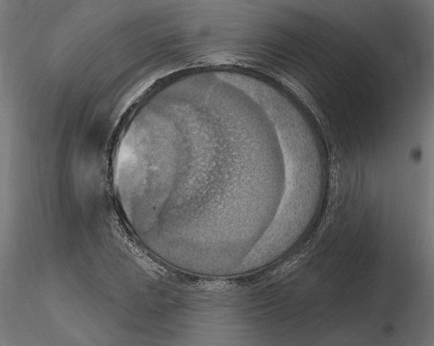 X0000116511023201001061218