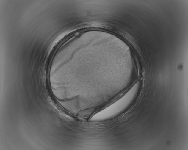 X0000116511024201001061218