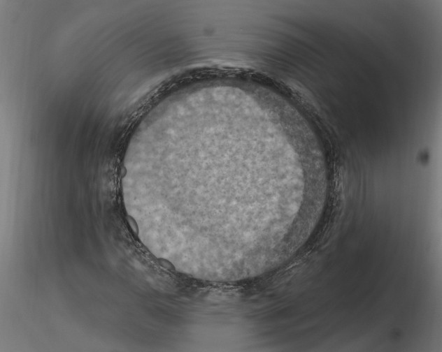 X0000116511110201001061217