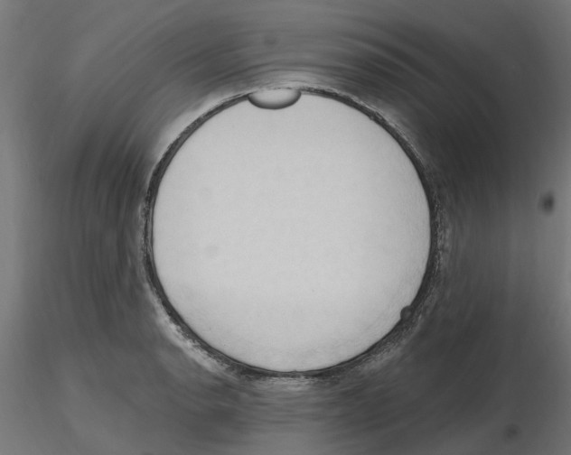 X0000116511134201001061217