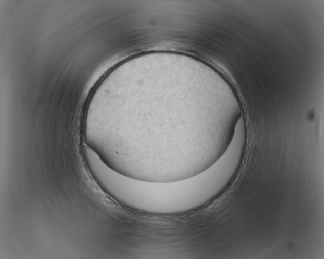 X0000116511138201001061217