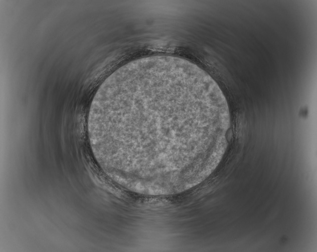 X0000116511154201001061217