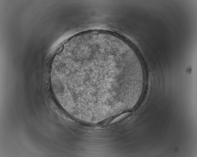 X0000116511359201001061214