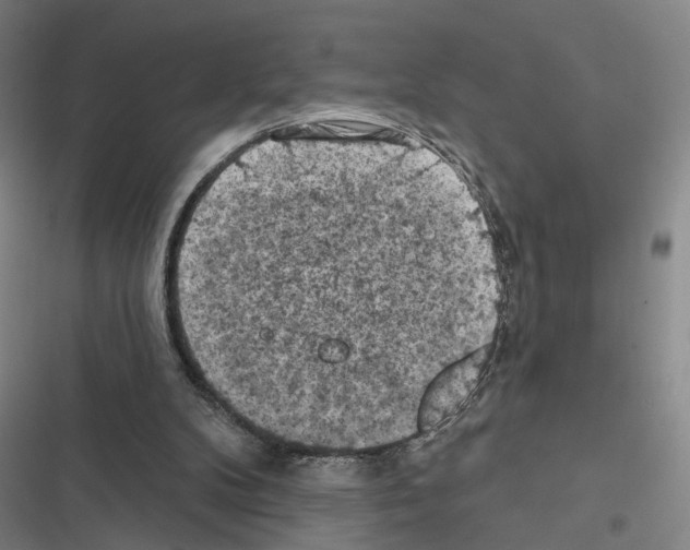 X0000116510104201001201453