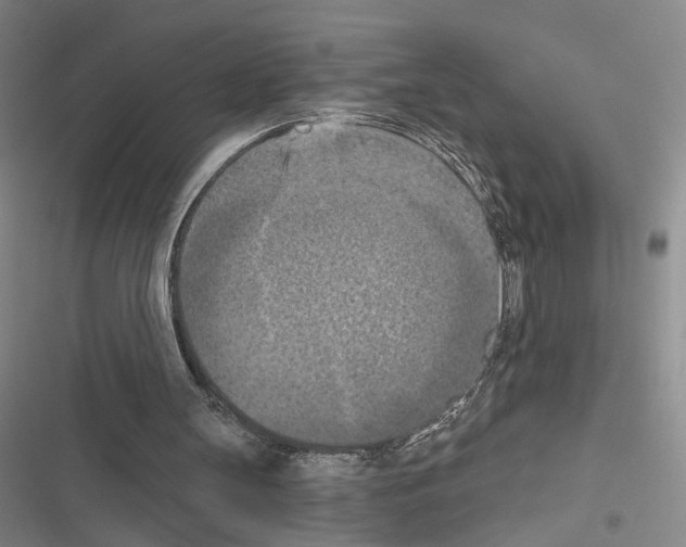X0000116510147201001201452